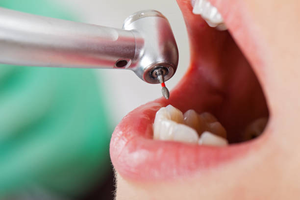 Best Cosmetic Emergency Dentistry in Havre De Grace, MD